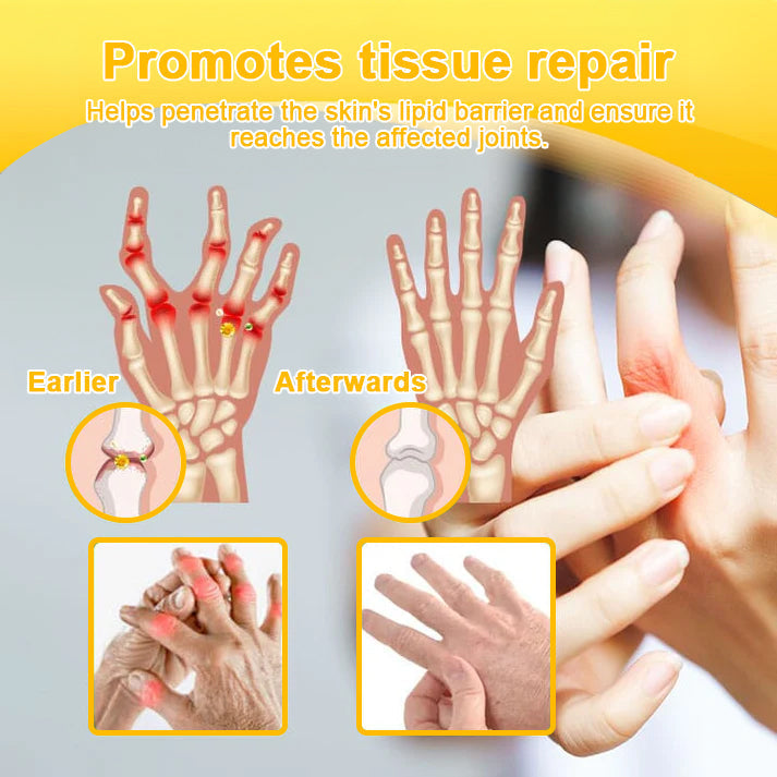 šAQA⢠Botulinum & Bee Essence Pain Relief Bone Healing Cream
