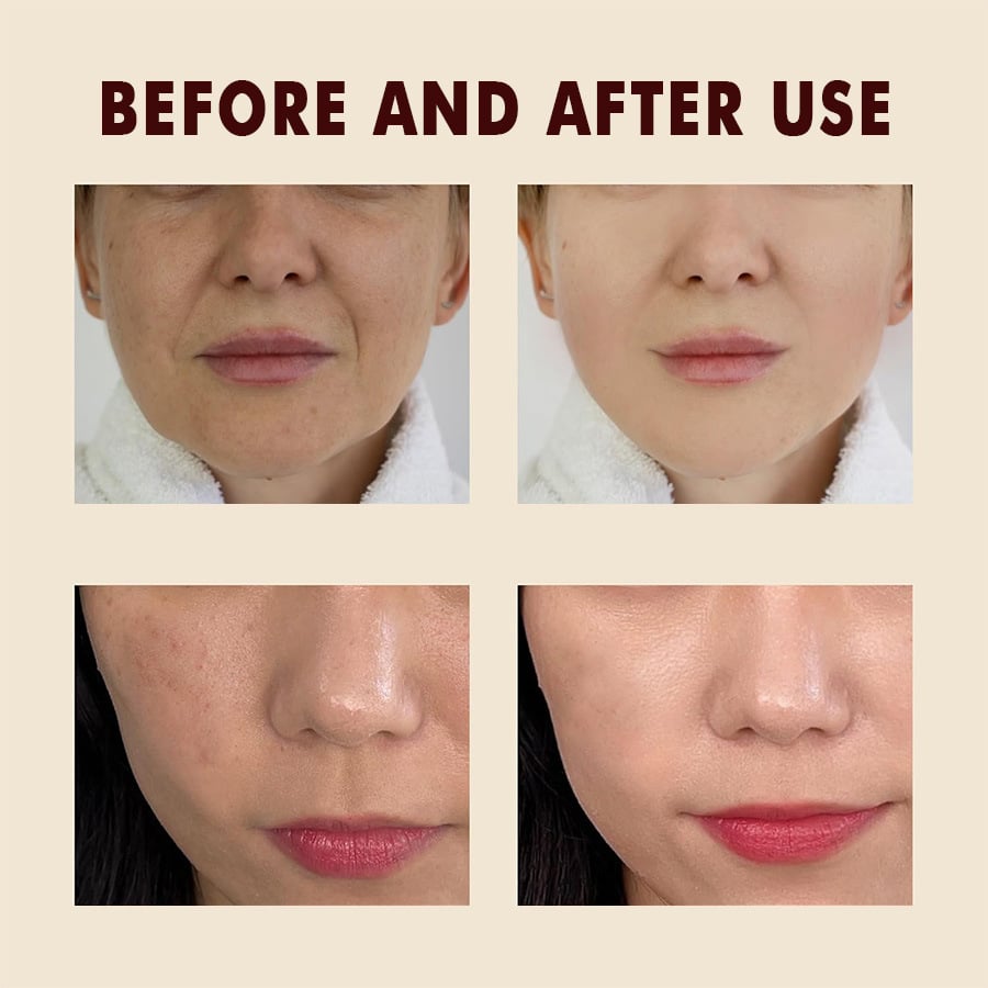 ⏰ Ends Today: 83% OFF-LOVILDS™ Rice Glow Exfoliating & Brightening Duo