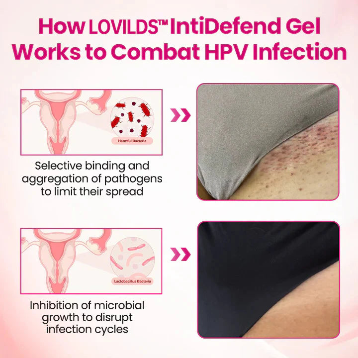 HPV negative conversion power MAX! 🌸LOVILDS™ interferon gel: Targeting high-risk viruses and repairing the cervix in one step