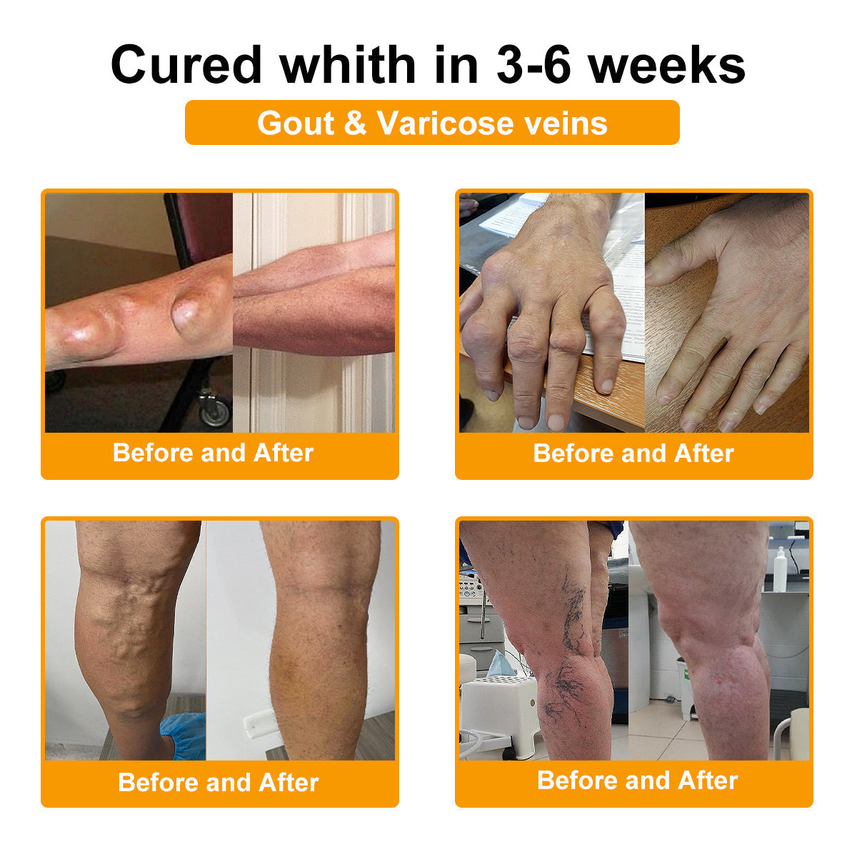 šAQA⢠Botulinum & Bee Essence Pain Relief Bone Healing Cream
