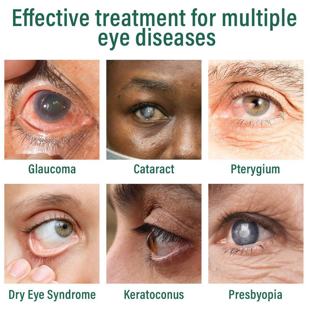 👩⚕️LOVILDS™ Nano Eye Drops Serum ✅FDA Approved(Suitable for presbyopia, dry eye syndrome, glaucoma, and cataracts) 👀