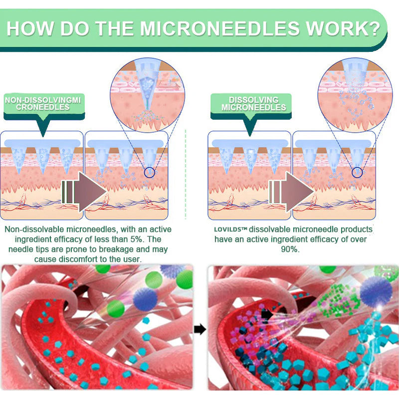【Last Minute! 80% OFF】LOVILDS™ Tirzepatide Slimming & health NANO MICRONEEDLE PATCH 👩⚕️(Painless 24/7 Fat Burning | Lose 20 Pounds in Weeks | Crush Cravings Fast!
