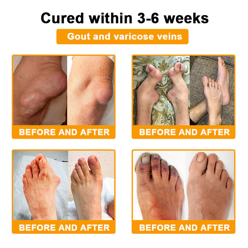 šAQA⢠Botulinum & Bee Essence Pain Relief Bone Healing Cream
