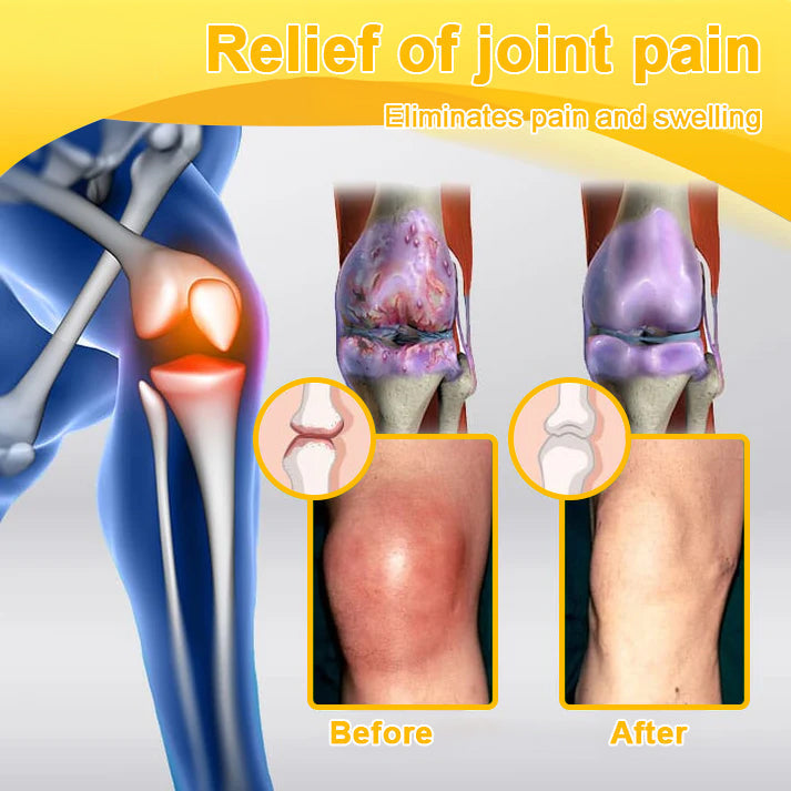 šAQA⢠Botulinum & Bee Essence Pain Relief Bone Healing Cream