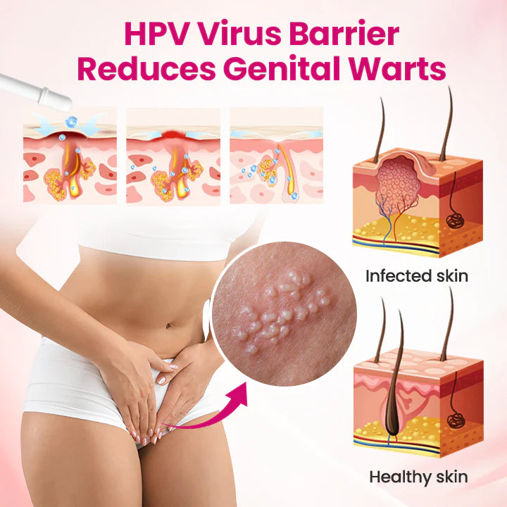 HPV negative conversion power MAX! 🌸LOVILDS™ interferon gel: Targeting high-risk viruses and repairing the cervix in one step