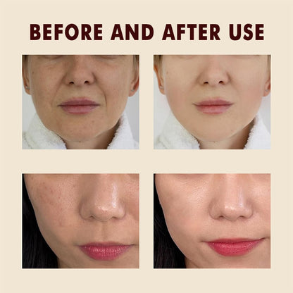 ⏰ Ends Today: 83% OFF-LOVILDS™ Rice Glow Exfoliating & Brightening Duo