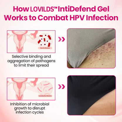 HPV negative conversion power MAX! 🌸LOVILDS™ interferon gel: Targeting high-risk viruses and repairing the cervix in one step