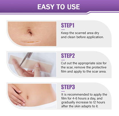 LOVILDS™ Hyaluronic Acid Nano Microneedle Repair Tape🏥(Treatment of old and new scars, reduction of surgical scars, stretch marks, keloids, acne, burns, warts, dermatomes and varicose veins)