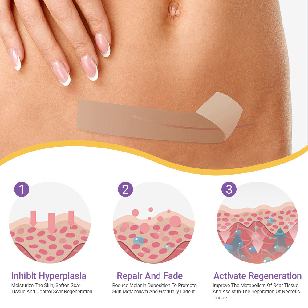 LOVILDS™ Hyaluronic Acid Nano Microneedle Repair Tape🏥(Treatment of old and new scars, reduction of surgical scars, stretch marks, keloids, acne, burns, warts, dermatomes and varicose veins)