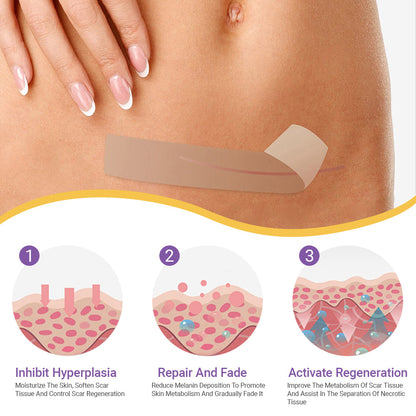 LOVILDS™ Hyaluronic Acid Nano Microneedle Repair Tape🏥(Treatment of old and new scars, reduction of surgical scars, stretch marks, keloids, acne, burns, warts, dermatomes and varicose veins)