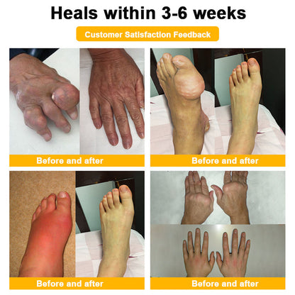 🐝AQA™ Botulinum & Bee Essence Pain Relief Bone Healing Cream