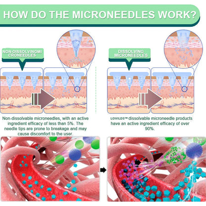 【Last Minute! 80% OFF】LOVILDS™ Tirzepatide Slimming & health NANO MICRONEEDLE PATCH 👩‍⚕️(Painless 24/7 Fat Burning | Lose 20 Pounds in Weeks | Crush Cravings Fast!