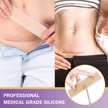 LOVILDS™ Hyaluronic Acid Nano Microneedle Repair Tape🏥(Treatment of old and new scars, reduction of surgical scars, stretch marks, keloids, acne, burns, warts, dermatomes and varicose veins)
